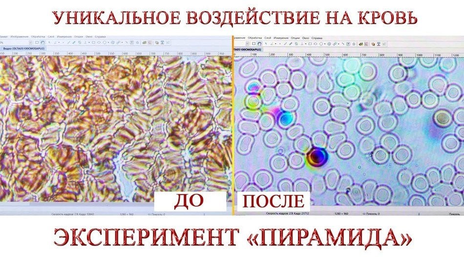 Уникальное воздействие на кровь. Эксперимент ПИРАМИДА