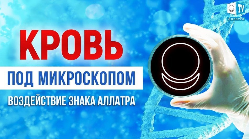 Интересные факты воздействия Знака АллатРа. Кровь под микроскопом